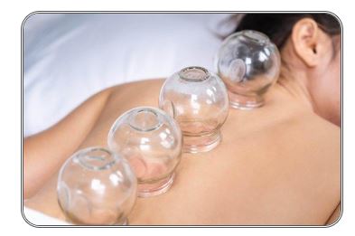 cupping 1