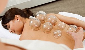 Cupping New